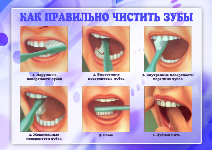Тест гигиена полости рта